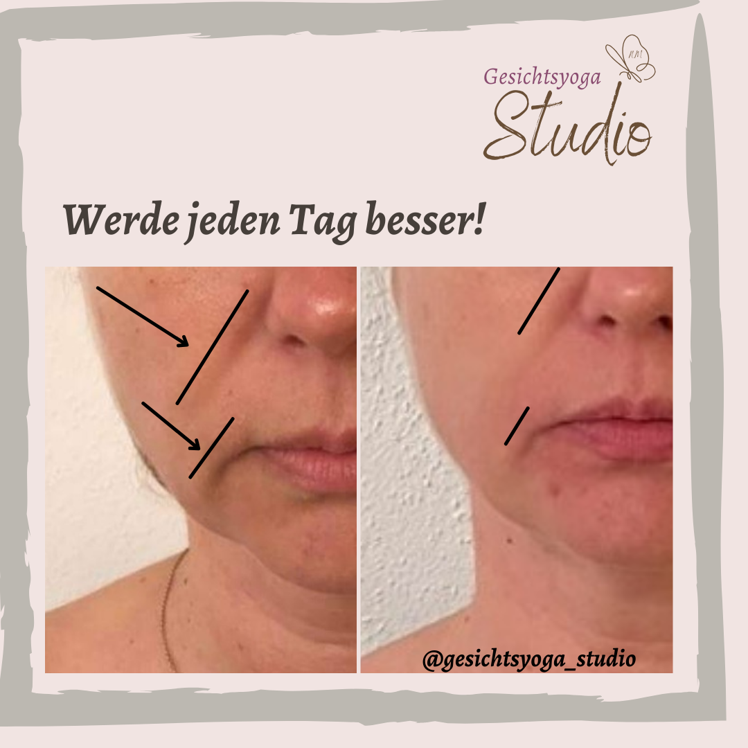 Banner für die Hängebäckchen- Challenge