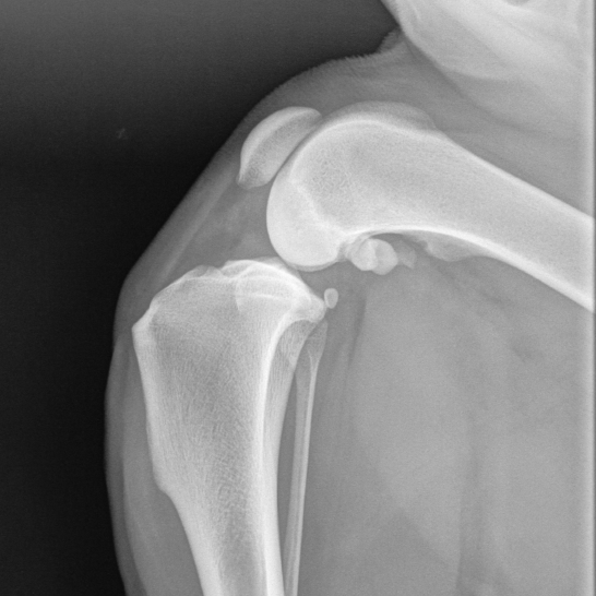 Roentgenbild Knie-546x546.png