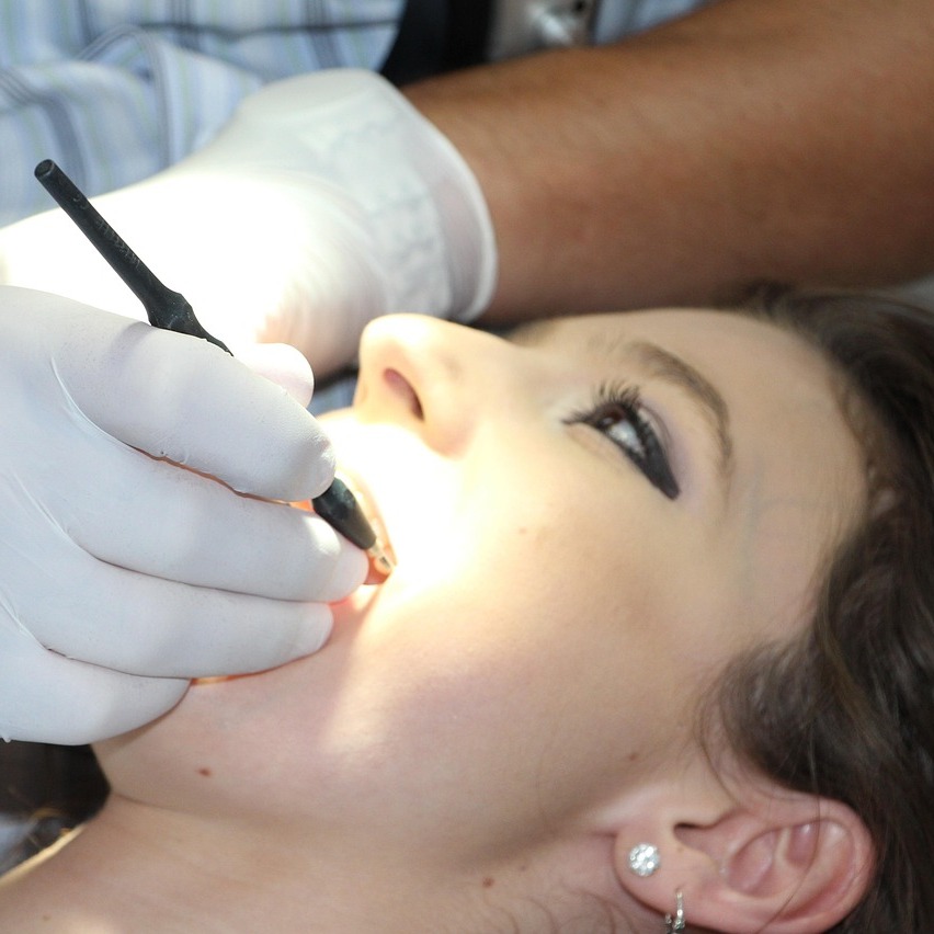 teeth-cleaning-1514692_1280-852x852.jpg