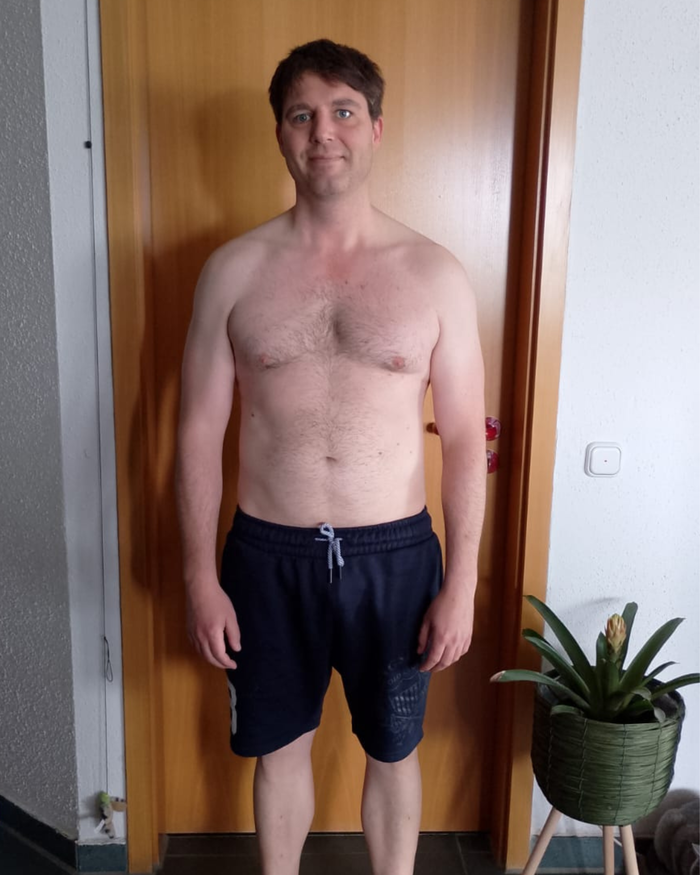 Vorher Bild Daniel - vorne