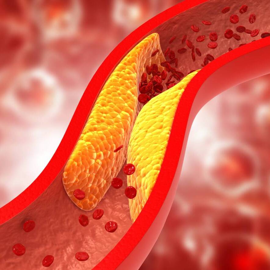 Cholesterin-Cholesterol-Laborwerte-885x885.jpg