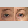 Banner für die Augenlift-Challenge